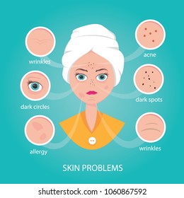 Modern vector illustration of skin problems. Dark dots, acne. Face care.