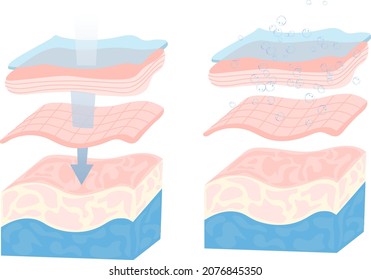 Moisturized skin, dry skin, cross section