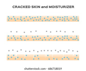 moisturizer lose . aging skin vector