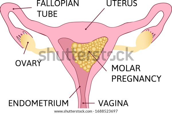 Rs 2 Anatomy Of The Female Reproductive System Flashcards Cram Com