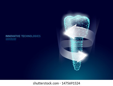 Molar tooth dental implant 3d low poly geometric model. Dentistry innovation future technology titan metal thread. Medical health science polygonal point line vector illustration