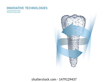 Molar tooth dental implant 3d low poly geometric model. Dentistry innovation future technology titan metal thread. Medical health science polygonal point line vector illustration