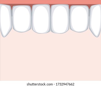 Molars and incisors on the upper jaw and place for text. Flat vector stock illustration with teeth and copyspace as a concept of healthy tooth and orthodontic services