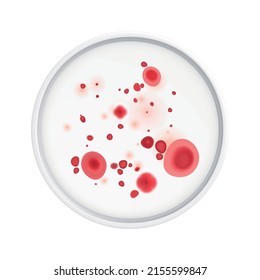 Mold fungus bacteria colony composition with isolated realistic image of laboratory plate with microbes vector illustration