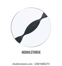 Monilethrix dañó la superficie del cabello con cuentas bajo microscopio. Vector de cierre del estado de la fragilidad folicular del pelo. Problema de fragilidad y rotura. Concepto médico de tricología.