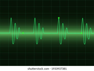 Monitor heart beats cardiogram loop on green graph screen background, medical and science vector design concept