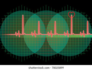 Monitor with red heart beat and graph