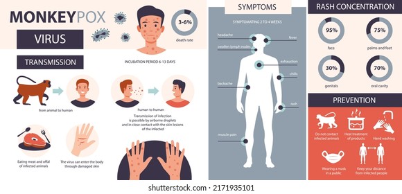 Infografía de varicela. Infección, síntomas, prevención de la enfermedad de la varicela. Ilustración vectorial plana.