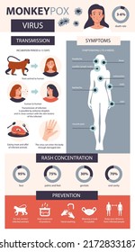 Monkey pox infographic. Infection, symptoms, prevention of the disease of monkey pox. Flat vector illustration.
