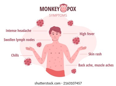 Monkey pox outbreak. Infographics of virus symptoms in humans. Vector illustration for informing people about an infectious disease.