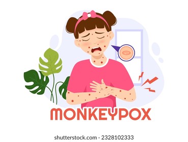 Monkey Pox Outbreak Vector Illustration of Virus Symptoms in Humans Monkeypox Microbiological in Flat Cartoon Hand Drawn Templates