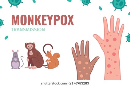 Monkey Pox Virus infographics with hand in rash and animal transmitters vector illustration