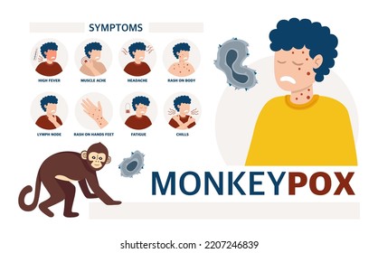 Monkey pox virus Poster to inform about the pandemic and the spread of the disease Images of a person and symptoms of the disease Vector 