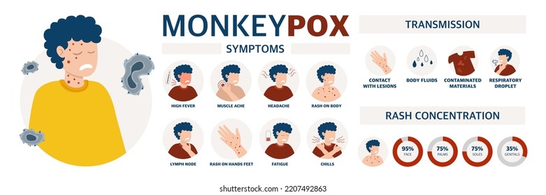 Monkey pox virus Poster to inform about the pandemic and the spread of the disease Images of human methods of spread and symptoms of the disease Vector 