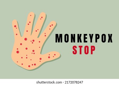 Monkey virus 2022 concept banner. Monkeypox virus outbreak concept.  