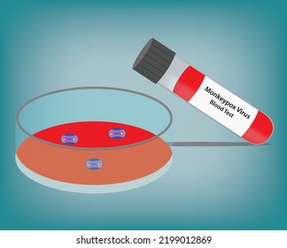 Monkeypox Blood Test with Test Tube 