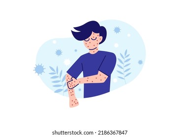 Monkeypox or Monkey Pox Symptoms Flat Illustration Vector Isolated. A man scratching his hand because of monkeypox symptoms