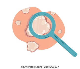 Monkeypox On Human Skin Concept. Close-up. Outbreak Of A Viral Infection. Rash. Studying Under A Magnifying Glass. Vector Editable Illustration