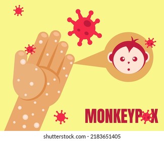 Monkeypox outbreak concept. Hands with virus. Cartoon vector style for your design.