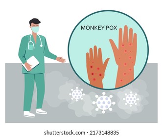 Monkeypox symptoms concept cartoon vector illustration.