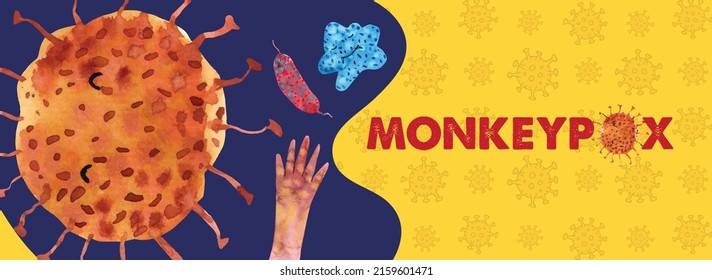 Monkeypox is a viral zoonosis (a virus transmitted to humans from animals) with symptoms very similar to those seen in the past in smallpox. Monkey pox illustration with virus background.