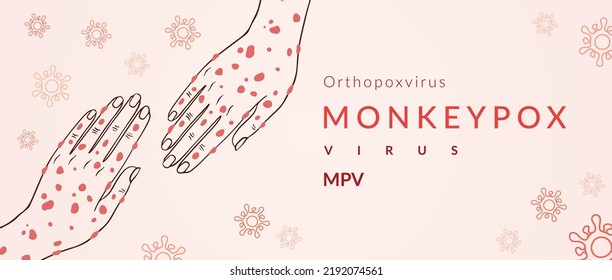 Monkeypox virus banner for awareness and alert against disease spread, Hand rash with monkeypox. Monkey Pox virus outbreak pandemic, pidemic from animals to humans. Monkeypox virus background