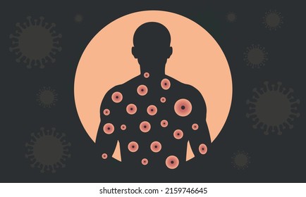 Monkeypox virus. Banner of monkeypox virus on black background. Dangerous disease.