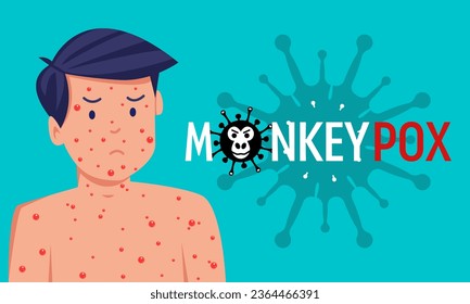 Monkeypox-Virus-Banner-Virus-Ausbruch Pandemie-Design mit mikroskopischen Blick Hintergrund. Vektorgrafik 