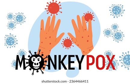 Monkeypox virus banner virus outbreak pandemic design with microscopic view background. Vector illustration 