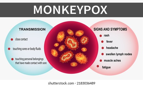 Células del virus de la monodosis. Conciencia de la transmisión, signos y síntomas de la varicela. Concepto de la viruela. Brote epidémico de virus. Atención de la salud en Estados Unidos, Europa y Asia. Ilustración del vector EPS10