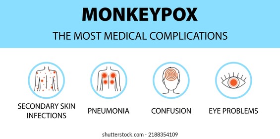 Iconos del virus de la monopox infográficos. Las complicaciones más médicas. Nuevos casos de brotes en Europa y Estados Unidos. Dibujo vectorial aislado.