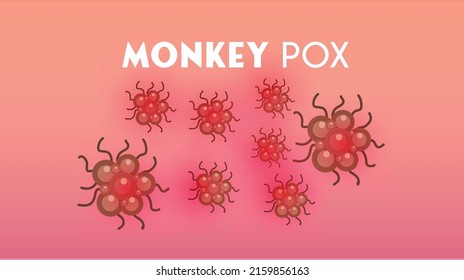 Monkeypox virus illustration, Monkeypox concept, Monkeypox virus outbreak pandemic design with microscopic view background