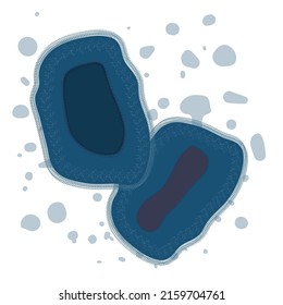 Monkeypox Virus Infection Bacteria Structure. Poxvirus Rare Disease. Health Care And Medical Concept. Vector Illustration.