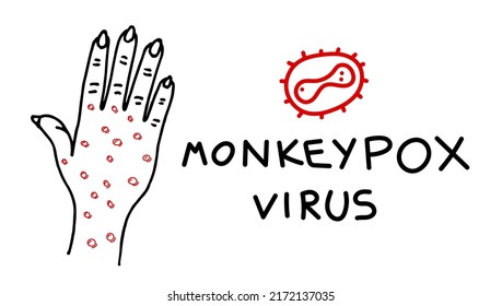 Monkeypox virus infection on hand drawing banner concept. Monkey pox disease outbreak blisters and rash on hand skin. MPV MPVX danger and public health epidemic risk. Vector eps linear illustration