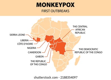 Monkeypox virus infographic. African map of first outbreaks. New outbreak cases in Europe and USA. Vector cartoon isolated illustration.