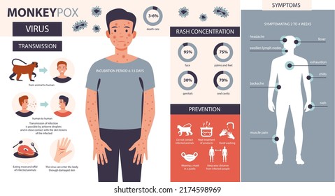 Monkeypox virus infographic. Infection, symptoms, prevention of the disease of monkey pox. Flat vector illustration