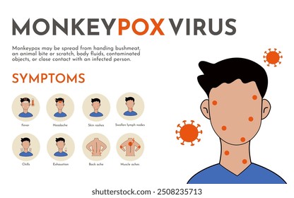 Monkeypox virus infographic. Infection, symptoms, prevention of the disease of monkey pox. Flat vector illustration of Monkeypox virus suitable for education and awareness.