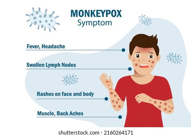 Monkeypox virus symptom infographic on patient with fever, headache, swollen lymph node, rashes on face, body and back, muscle aches. For awareness in spreading of orthopoxvirus outbreak. 