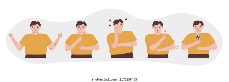 Monkeypox virus symptom infographic on human, flat design. Patient demonstrate symptoms. Vector illustration for informing of orthopoxvirus outbreak, monkeypox virus, epidemic virus, skin infections. 