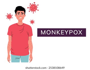 Varíola do macaco. Vírus. Sintomas da doença. Médico. Febre, calafrios, dor muscular, erupção cutânea, infecção da pele, linfonodos inchados. Infográfico. Gripe. África.  Infecção. Estilo plano. Varíola. Doutor. Modelo para design
