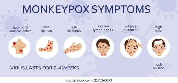 Monkeypox virus symptoms illustration with woman character.
Monkeypox outbreak concept by world health organization with
examples and explanation.
