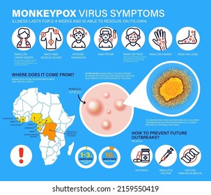 Síntomas del virus de la varicela. Se reportan nuevos casos de virus Monkeypox en Europa y Estados Unidos. La varicela se está propagando en Europa. Causa infecciones cutáneas. Infografía detallada del virus de la monografía