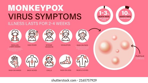 Monkeypox virus Symptoms. New cases of Monkeypox virus are reported in Europe and USA. Monkeypox is spreading in the Europe. It cause skin infections. Monkeypox virus Symptom infographics