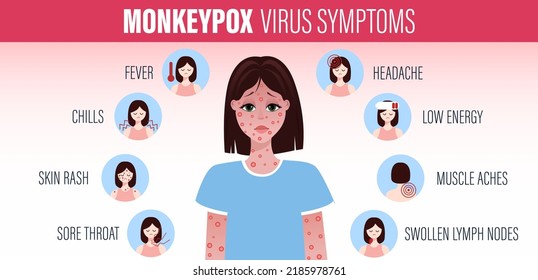 Monkeypox virus Symptoms. New cases of Monkeypox virus are reported in Europe and USA. Monkeypox is spreading in the Europe. It cause skin infections. Monkeypox virus Symptom infographics