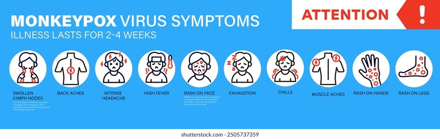 Affenpocken-Virus Symptome. In Europa und den USA werden neue Fälle von Monkeypox-Viren gemeldet. Die Pocken breiten sich in Europa aus. Es verursacht Hautinfektionen. Monkeypox-Virus Symptom-Infografiken