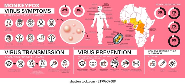 Symptome des Monkeypox-Virus, Übertragung und Prävention. Große detaillierte Infografik mit einer großen Anzahl von Symbolen. Die Ausbreitung der Epidemie. Virusepidemie. Moderne flache Vektorgrafik