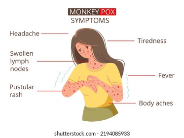 Monkeypox virus symptoms. Vector illustration for informing people about infectious disease. Sick person with red rash infected with monkeypox