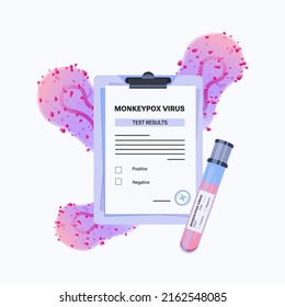 Monkeypox virus vector illustration purple clipboard with results of test. Blood sample tube for Monkeypox virus test. Monkeypox virus zoonotic viral disease 
