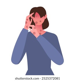 Monkeypox virus. Woman with with rashes on face, body and back, one of Monkeypox symptom. Fever, headache, swollen lymph node, muscle aches. Flat vector illustration. Not AI generated