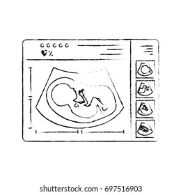 monochrome blurred silhouette of monitoring ultrasound of baby in device vector illustration